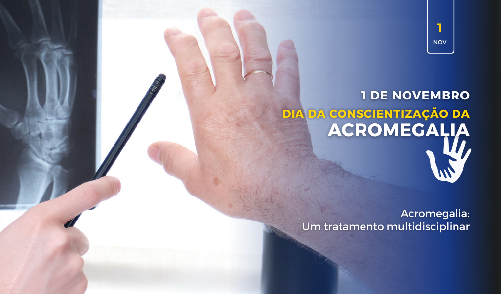 Campanha Conscientização da Acromegalia 2023