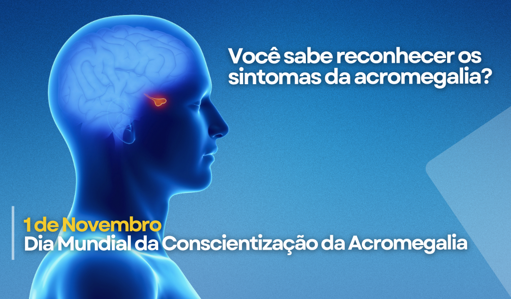 Dia Mundial de Conscientização da Acromegalia: Sinais, Sintomas e Tratamento
