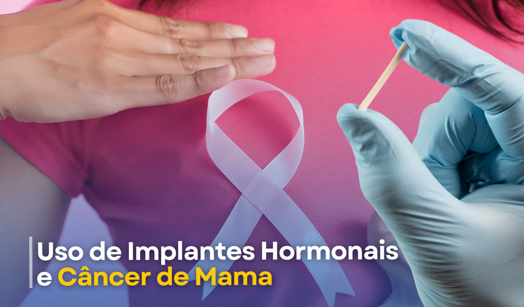 Nota Oficial: Uso de Implantes Hormonais e Câncer de Mama