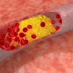 10 Coisas que Você Precisa Saber sobre o Colesterol